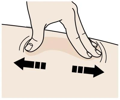 Una mano pellizca la piel creando un pliegue entre el pulgar y el