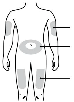 Esquema del cuerpo humano con áreas grises resaltadas en brazos, abdomen y muslos, conectadas por líneas negras a puntos específicos para la