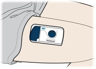 Un dispositivo médico rectangular con un botón circular y una ventana se aplica sobre la piel de la zona abdominal