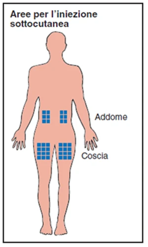 Esquema del cuerpo humano con áreas cuadradas azules que indican los puntos para la