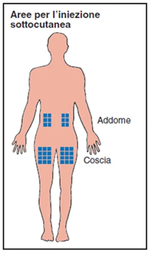Esquema del cuerpo humano con áreas azules que indican los puntos para la