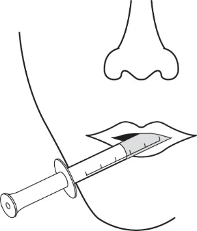 Dibujo lineal de un rostro que muestra nariz y boca con una jeringa insertada en la
