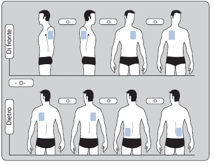 Diagrama médico con cuatro figuras masculinas vistas de frente y cuatro vistas de espalda que muestran las zonas del cuerpo para la