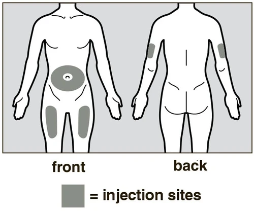 Front and back human body diagram with shaded areas indicating subcutaneous injection sites on the