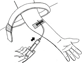 Disegno tecnico di un braccio con laccio emostatico e un tubicino inserito in una vena mentre una mano impugna una siringa per il prelievo