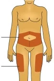 Diagram ciała męskiego z brązowymi obszarami na