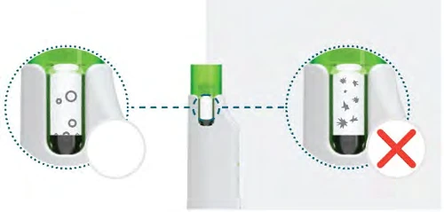 Diagrama médico que compara un frasco con burbujas de