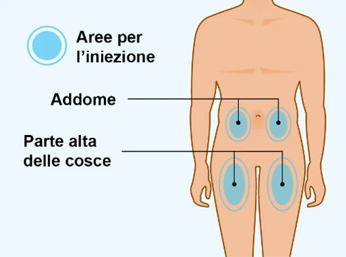 Diagram of a human body indicating areas for the