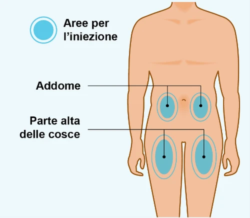 Diagram of a human body indicating areas for the