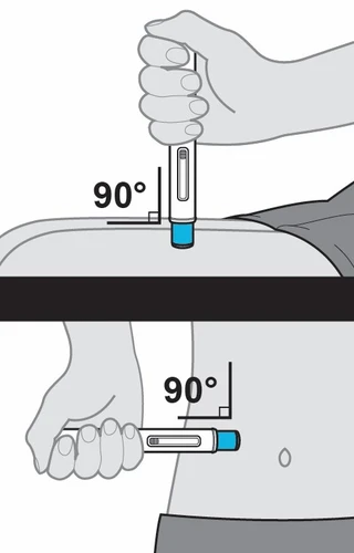 Ilustración médica que muestra dos formas de inyectar con una pluma a 90 grados en la parte superior del muslo y en la