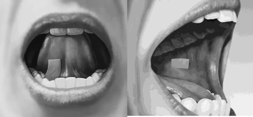Dos fotografías en blanco y negro muestran una boca abierta con una pastilla rectangular colocada sobre la lengua, vista frontal y lateral