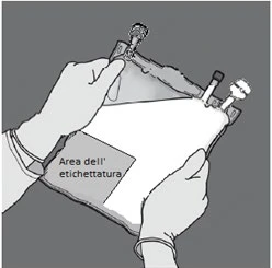 Two gloved hands holding an infusion bag with a