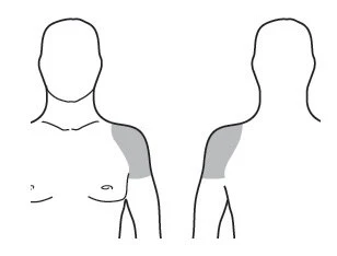 Schematic drawing of a male torso showing front and back views, with the deltoid muscle area highlighted in gray
