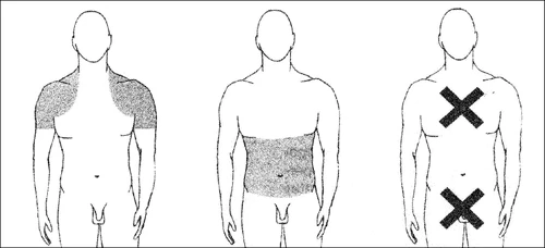 Tres figuras masculinas estilizadas muestran áreas de aplicación: brazos y tórax, abdomen, y zonas con una X negra sobre el tórax e ingles