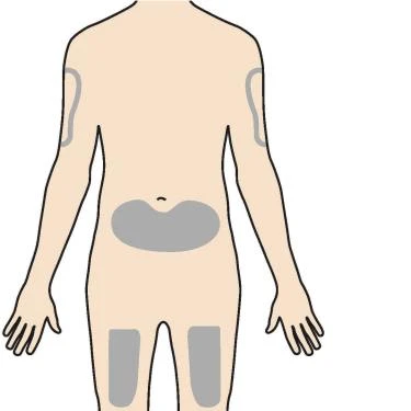 Human body diagram viewed from the back with gray highlighted areas on the arms, on the