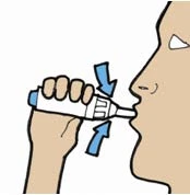 Illustration of a hand holding a white medical device near a person's mouth with two blue arrows indicating the direction of use
