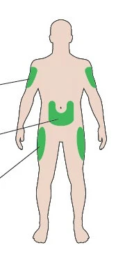 Diagrama de un cuerpo humano con áreas verdes resaltadas en los hombros, en la
