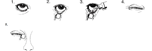 Secuencia de cinco dibujos que muestran la