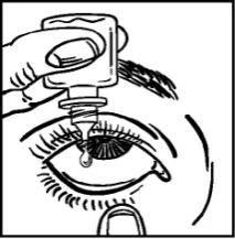 Una mano sostiene un frasco cuentagotas sobre un ojo abierto mientras una gota de líquido está a punto de caer sobre la superficie ocular