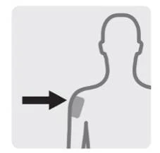 Diagrama estilizado de un torso humano con una flecha negra que apunta hacia la parte superior del brazo derecho para indicar el sitio de inyección