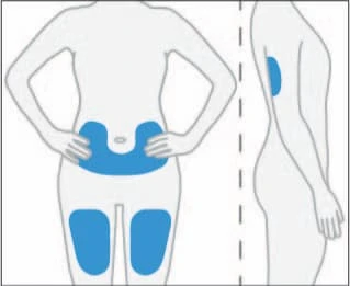 Human body diagram showing blue areas on the abdomen, hips, and thighs in frontal and lateral views to indicate injection sites