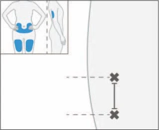 Diagrams of the human body indicating the drug administration sites on