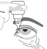 A hand holding a dropper bottle to instill a drop of medicine into the eye
