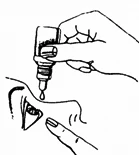 Una mano sostiene un frasco cuentagotas para administrar una gota de líquido al ojo