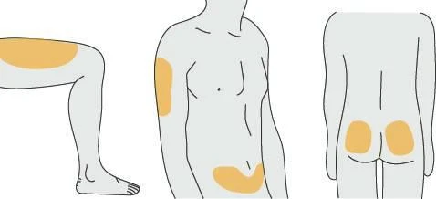 Schematic diagrams of a human body showing orange-colored areas on the arm, abdomen, buttocks, and thigh to indicate injection sites