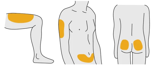 Schematic diagrams of a human body indicating drug application areas on thigh and hip