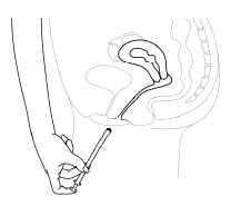 Schematic drawing of the female pelvis showing the
