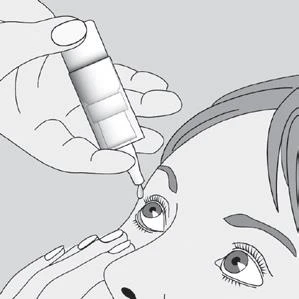 Dibujo en blanco y negro que muestra una mano sosteniendo un frasco cuentagotas para administrar gotas oftálmicas en el