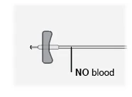 Медицинская схема, показывающая иглу с серой бабочкой и надпись NO blood рядом с трубкой, указывающую на отсутствие крови
