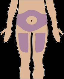 Diagrama del cuerpo humano que muestra áreas de aplicación coloreadas en morado sobre la