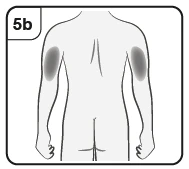Dibujo esquemático de la espalda de un hombre con dos áreas circulares grises que indican los puntos de aplicación en los brazos superiores