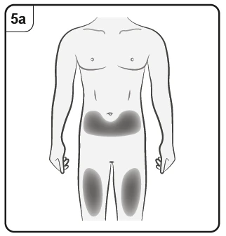 Esquema del torso y piernas de un hombre con áreas grises oscuras que indican los sitios de inyección en la