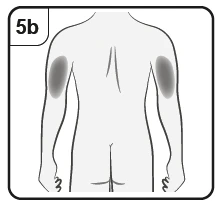 Esquema del torso humano visto por detrás con dos áreas grises ovales colocadas en la parte externa superior de ambos brazos