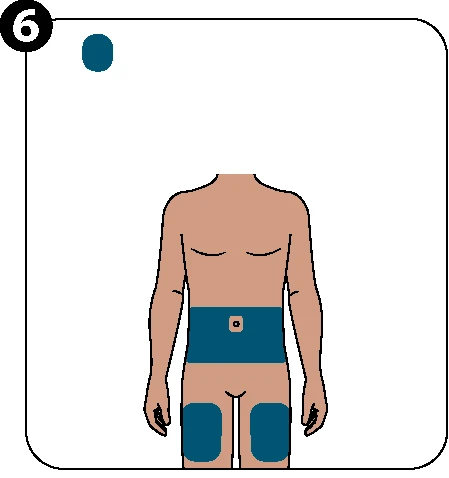 Diagrama médico que muestra un torso humano con un parche aplicado en el