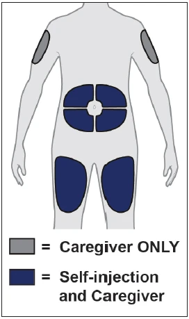 Diagram ciała ludzkiego z szarymi obszarami na ramionach dla opiekuna oraz niebieskimi na brzuchu i udach do samoiniekcji i przez opiekuna