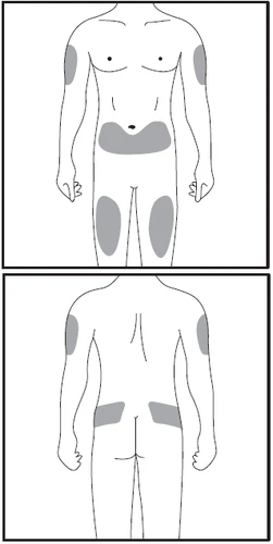 Diagrama del cuerpo humano que muestra áreas grises para la