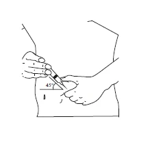 Line drawing showing a hand holding a syringe and inserting it into the