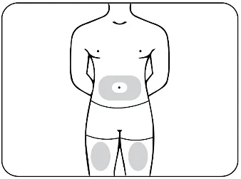 Dibujo esquemático de un torso humano con áreas grises resaltadas en la