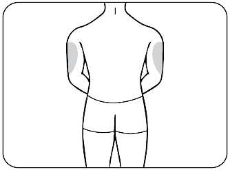 Dibujo esquemático de la espalda de un hombre con dos áreas grises resaltadas en la parte superior de los brazos para indicar los sitios de inyección