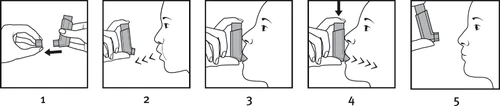 Cinque passaggi schematici per l'uso dell'inhalatore: separare il dispositivo, avvicinarlo alla bocca, inspirare, premere l'erogatore e allontanare l'inhalatore