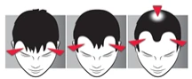 Three diagrams of a man's face with red arrows pointing to the forehead and temples, illustrating locations of headache pain