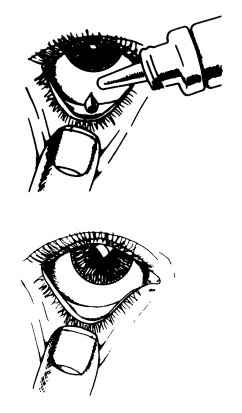 A black line drawing instruction showing a drop of medication entering the eye and the eye with the lower eyelid held down by a finger