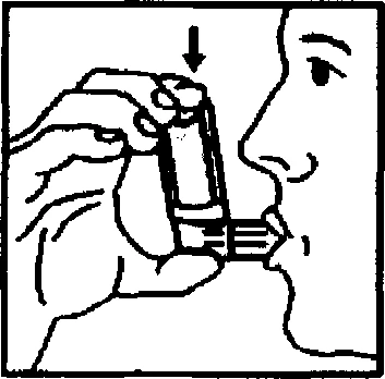 Mano sosteniendo un inhalador cerca de la boca de un perfil facial de una persona preparándose para inhalar, con una flecha apuntando hacia abajo indicando el dispositivo