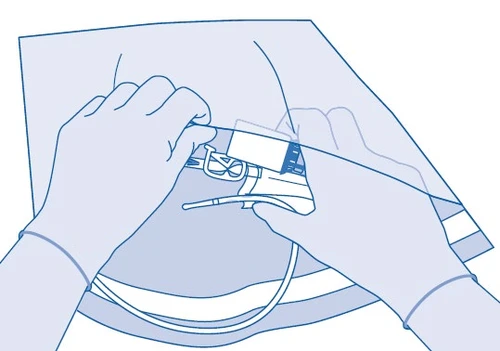 Dos manos con guantes azules sostienen y preparan un dispositivo médico blanco con un tubo delgado y un elemento de fijación