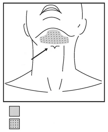 Schematic outline of the face and neck with a dotted area marked beneath the jawline, indicated by a black arrow