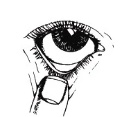 Primer plano de un ojo humano con el dedo índice separando suavemente el párpado inferior hacia abajo para aplicar el medicamento